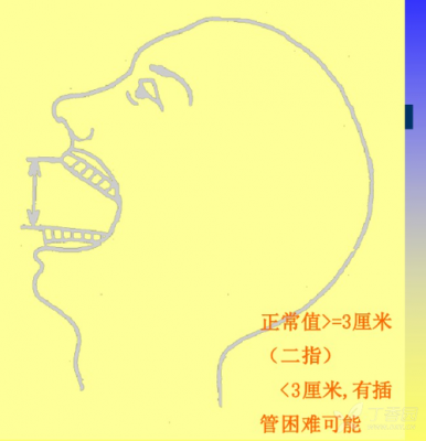 正常张口度多少厘米（张口度标准）